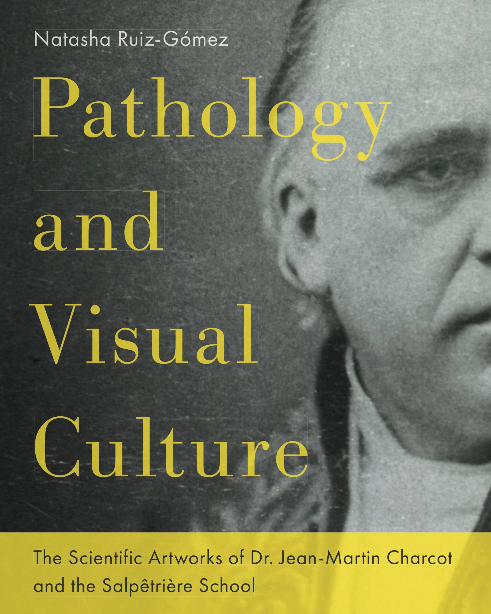 Featured image for “Pathology and Visual Culture: The Scientific Artworks of Dr. Jean-Martin Charcot and the Salpêtrière School”